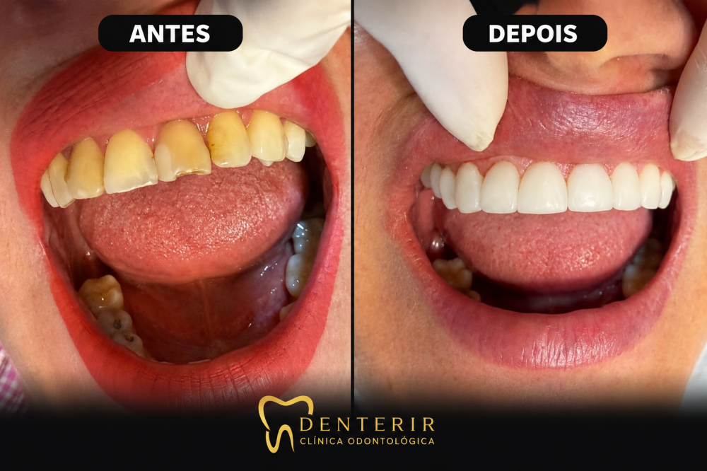 Galeria DENTERIR Odontologia